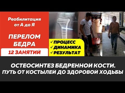 Сложный перелом бедра после остеосинтеза: от костылей к полной амплитуде