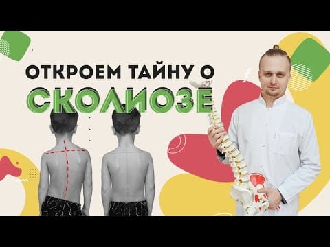 Сколиоз. Истинный сколиоз и сколиотическая осанка. Как остановить искривление позвоночника.
