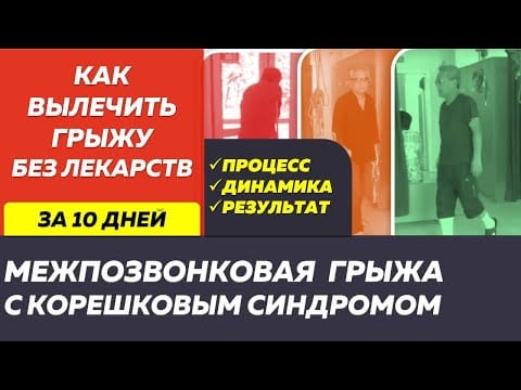 Грыжа с корешковым синдромом: результат за 10 дней