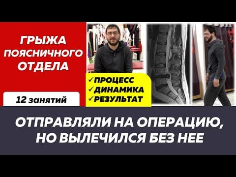 Межпозвонковая грыжа без операции и лекарств: история Рамазана