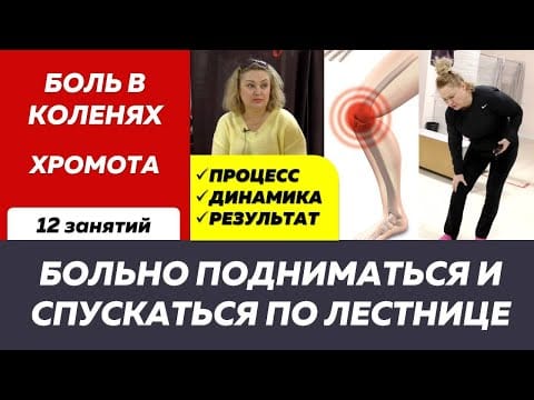 Боль в коленях и хромота: когда лечение идёт не по плану