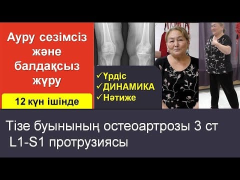 Остеоартроз коленей 2-3 степени и протрузии: дневник лечения