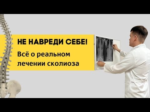 Лечение #сколиоза, которое реально эффективно. Методики, принципы. Как выбрать врача?