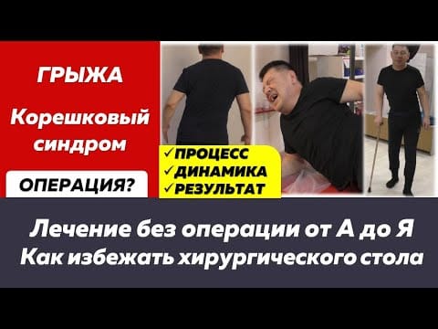 Грыжа с корешковым синдромом, из-за которой перекосило туловище