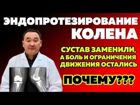 Замена коленного сустава