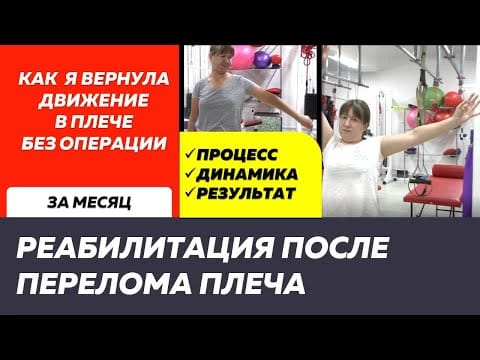 Сложный перелом плеча: рука снова поднимается