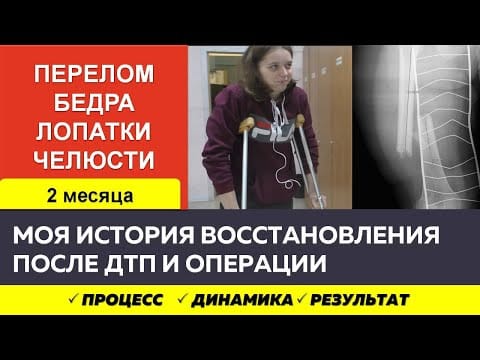 Реабилитация после ДТП: перелом бедра, лопатки и челюсти