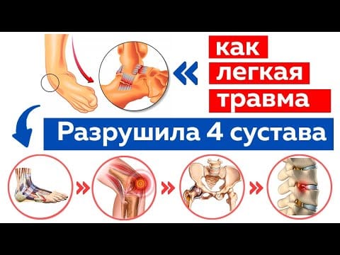 Проверь себя! Опасная травма, которую получали все! Чего стоит бояться?