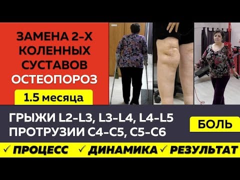 Жизнь без костылей после эндопротезирования двух коленей