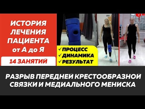 Разрыв передней крестообразной связки и мениска: восстановление после операции